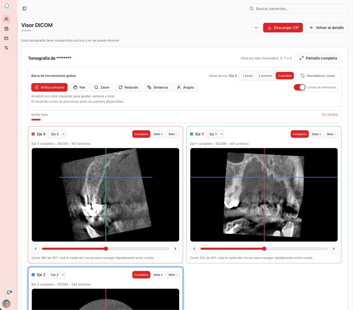 Visor DICOM dentro de Dentario